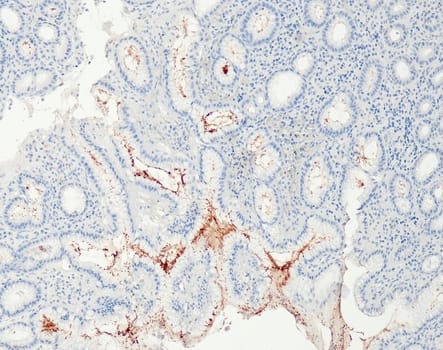 Helicobacter pylori (QR091) Rb 1,0 ml konsentraatti