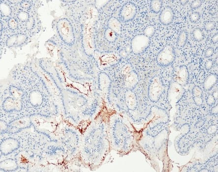 Helicobacter pylori (QR091) Rb 7 ml RTU liuos