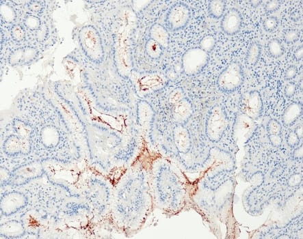 Helicobacter pylori (QR091) Rb 15 ml RTU liuos