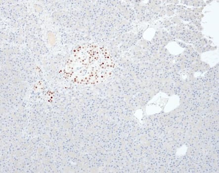 INSM1 (QR128) Rb 0,5 ml konsentraatti