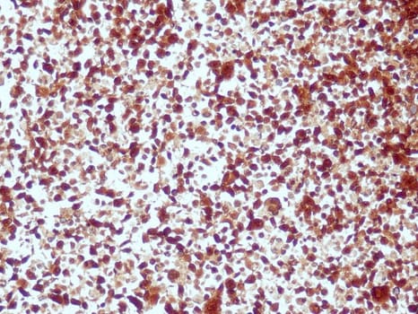 ALK (QR017) Rb 3 ml RTU