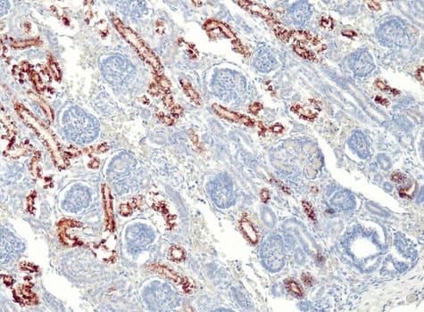 AMACR (QR108) Rb 3 ml RTU