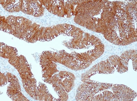 Beta-Catenin (QR095) Rb 3 ml RTU