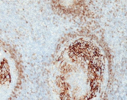 CD23 (QR036) Rb 0,5 ml konsentraatti