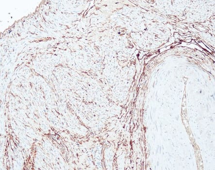CD34 (QR093) Rb 0,5 ml konsentraatti