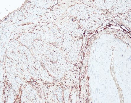 CD34 (QR093) Rb 3 ml RTU liuos