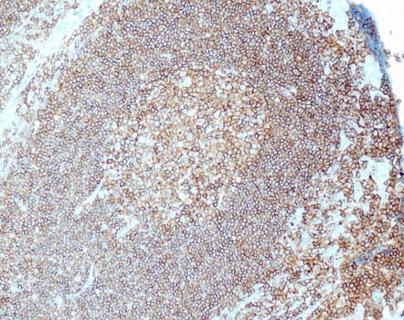 CD45/LCA (QR016) Rb 0,5 ml konsentraatti
