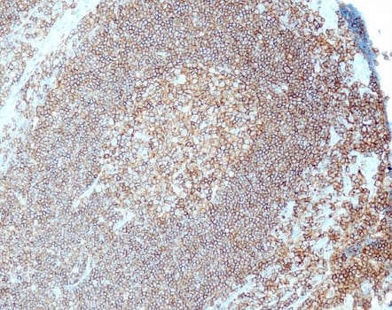 CD45/LCA (QR016) Rb 3 ml RTU liuos