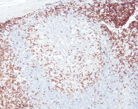 CD3e (QR004) Rb 3 ml RTU liuos
