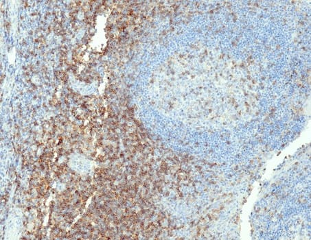 CD4 (QR032) Rb 3 ml RTU liuos