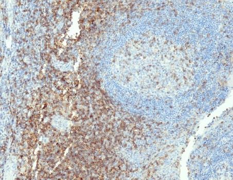 CD4 (QR032) Rb 7 ml RTU liuos