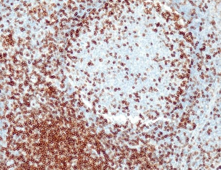CD5 (QR111) Rb 0,5 ml konsentraatti