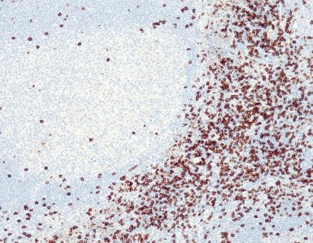 CD8 (QR068) Rb 3 ml RTU liuos