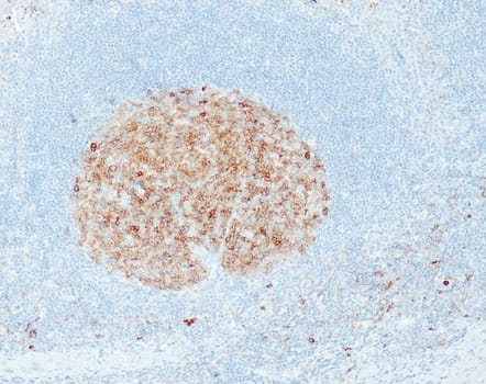 CD10 (QR021) Rb 7ml RTU liuos