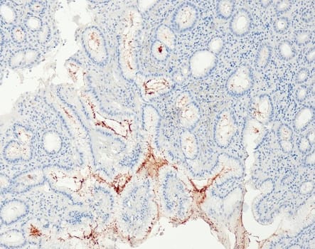 Helicobacter pylori (QR091) Rb 0,1 ml konsentraatti