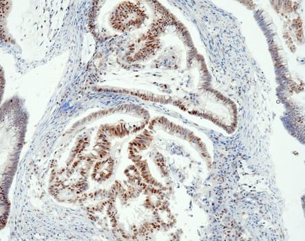 MSH6 (QR011) Rb 1,0 ml konsentraatti