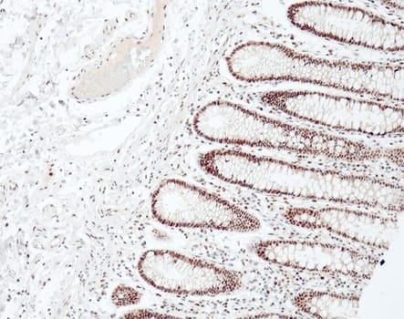 MLH1 (QM003) Ms 0,5 ml konsentraatti