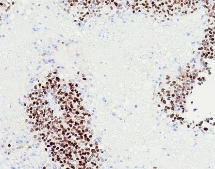 GATA3 (QR018) Rb 3 ml RTU liuos