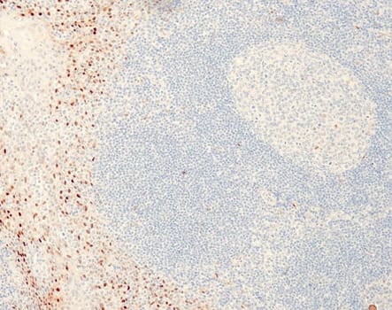 Cyclin D1 (QR022) Rb 0,5 ml konsentraatti