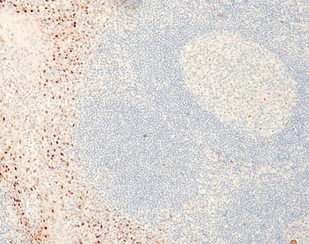 Cyclin D1 (QR022) Rb 3 ml RTU liuos