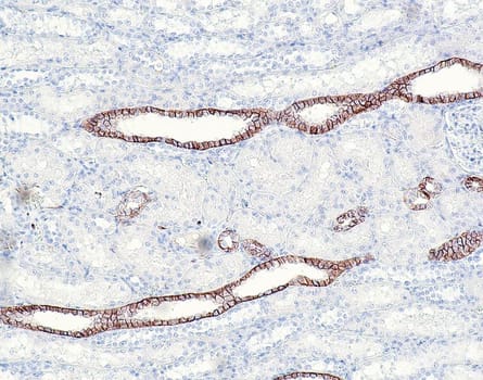 CD171/L1CAM (QR039) Rb 1,0 ml konsentraatti
