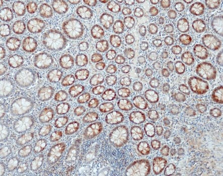 CDK4 (QR115) Rb 3 ml RTU liuos