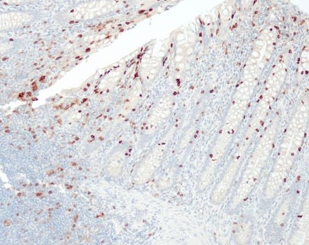 CD103 (QR081) Rb 1,0 ml konsentraatti