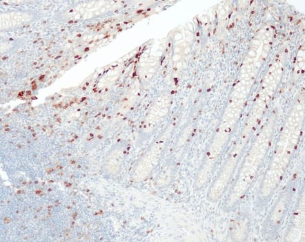CD103 (QR081) Rb 3 ml RTU liuos