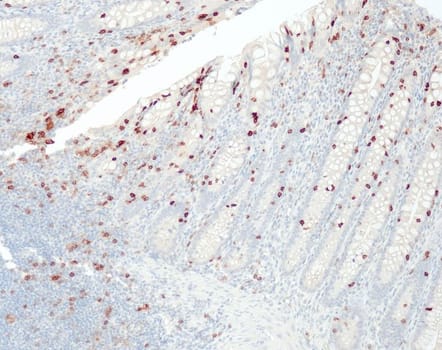 CD103 (QR081) Rb 7 ml RTU liuos