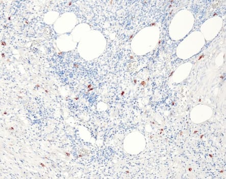 CD117 (QR012) Rb 3 ml RTU liuos