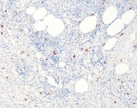 CD117 (QR012) Rb 7 ml RTU
