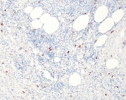 CD117 (QR012) Rb 15 ml RTU