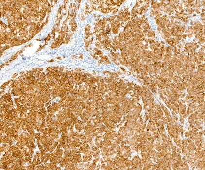 Melan A (QR138) Rb 7 ml RTU liuos (Research Use Only)