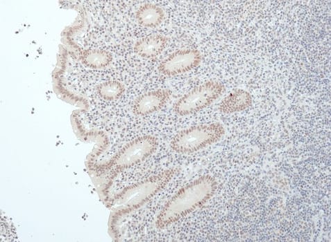 BAP1 (QR119) Rb 3 ml RTU liuos (Research Use Only)