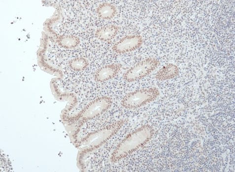 BAP1 (QR119) Rb 7 ml RTU liuos (Research Use Only)
