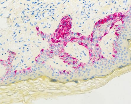 Melanoma (HMB-45) Ms 7 ml RTU liuos