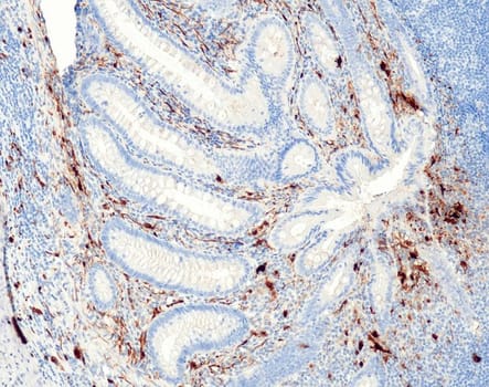 S100B (QR031) Rb 1,0 ml konsentraatti