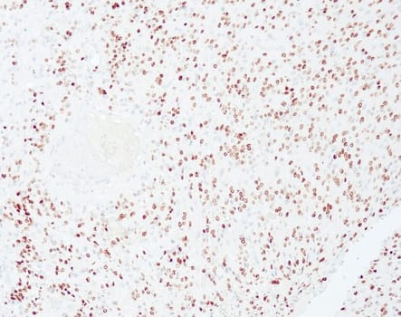 Olig2 (QR071) Rb 0.1 ml konsentraatti