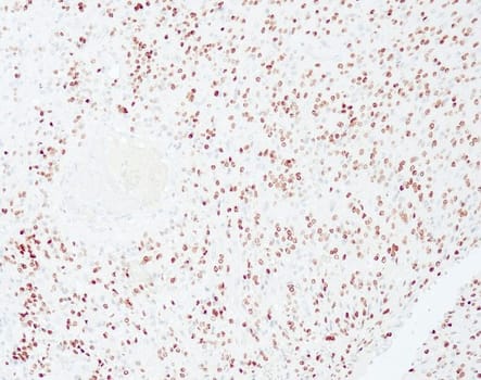 Olig2 (QR071) Rb 0.5 ml konsentraatti