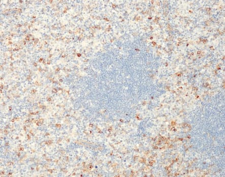 IRTA1 (QM005) Rb 0,1 ml konsentraatti
