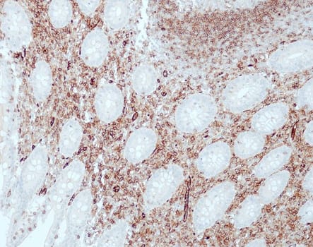 CD31 (QR034) 1,0 ml konsentraatti