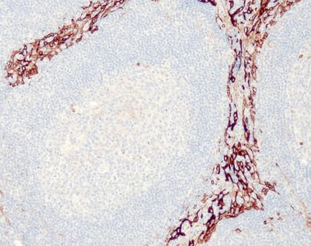 Cytokeratin 8 (QR112) 0,1 ml konsentraatti
