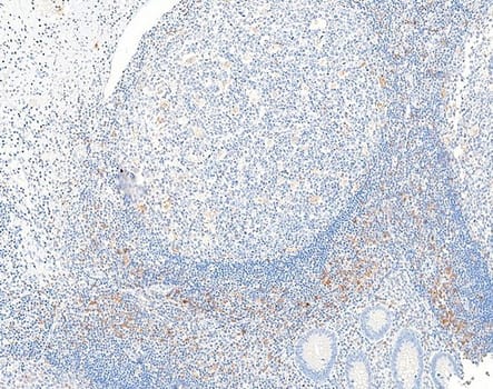 CD25 (QR171) Rb 0,1 ml konsentraatti (RUO, Research Use Only)