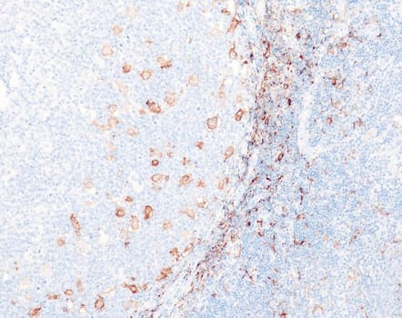 CD163 (QR162) Rb 0,5 ml konsentraatti (RUO, Research Use Only)