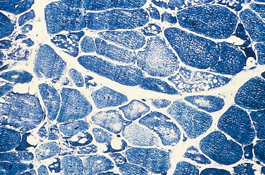 Myoadenylate deaminase -histoentsymaattinen kitti