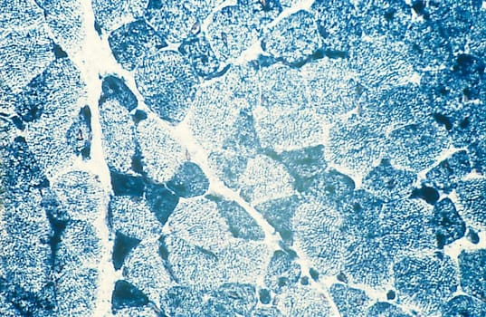Phosphofructokinase -histoentsymaattinen kitti