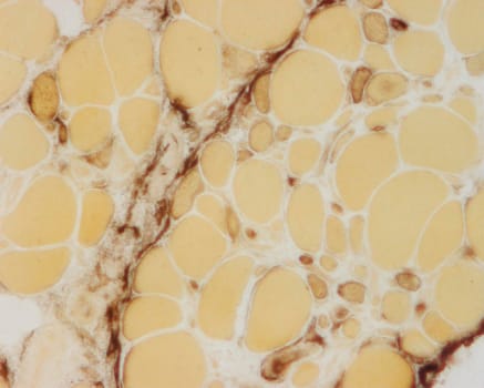 Alkaline phosphatase -histoentsymaattinen kitti