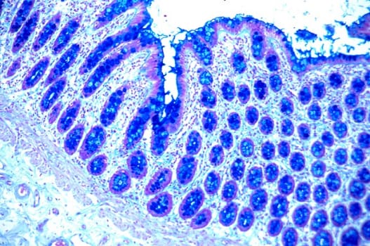 Colloidal Iron -osoitusvärjäyskitti