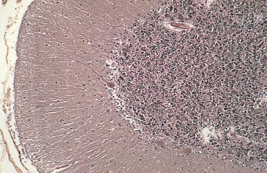 PTA Hematoksyliini -osoitusvärjäyskitti