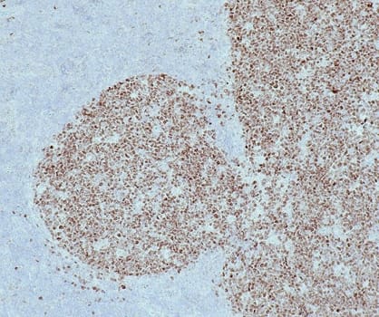 Bcl-6 (QR047) Rb 0,5 ml konsentraatti